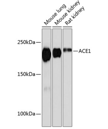 ACE1 Rabbit Monoclonal Antibody