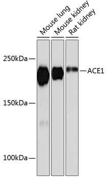 ACE1 Rabbit Monoclonal Antibody