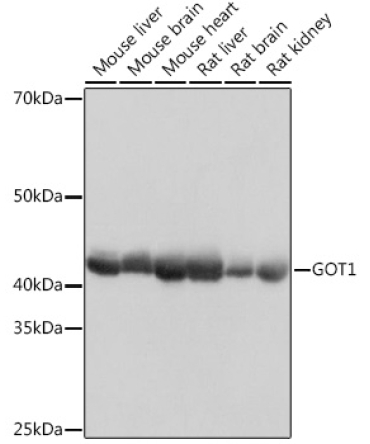 GOT1 Rabbit Monoclonal Antibody
