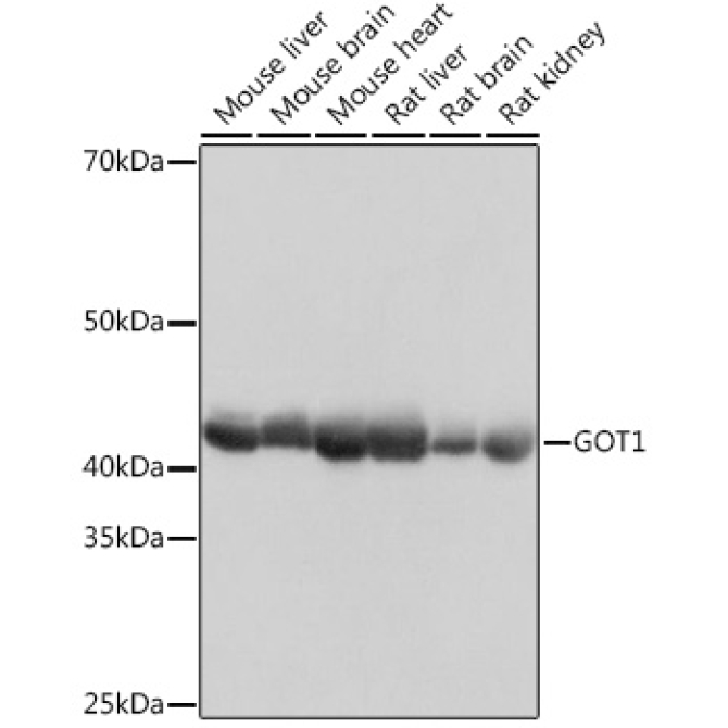 GOT1 Rabbit Monoclonal Antibody