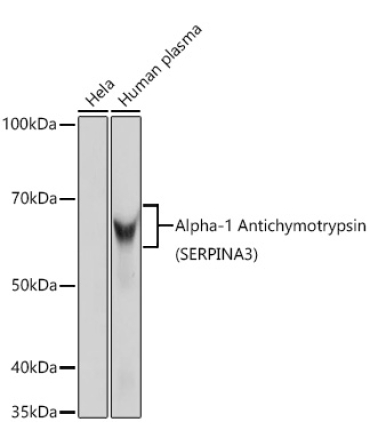 Alpha-1 Antichymotrypsin (SERPINA3) Rabbit Monoclonal Antibody