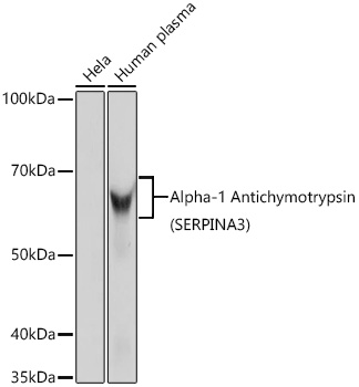 Alpha-1 Antichymotrypsin (SERPINA3) Rabbit Monoclonal Antibody