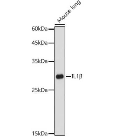 IL1Beta Rabbit Polyclonal Antibody