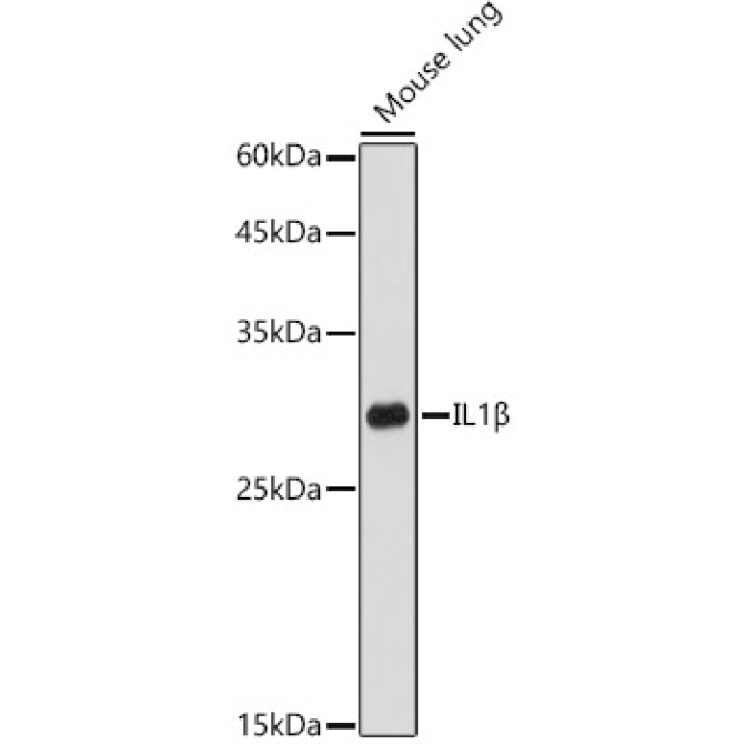 IL1Beta Rabbit Polyclonal Antibody