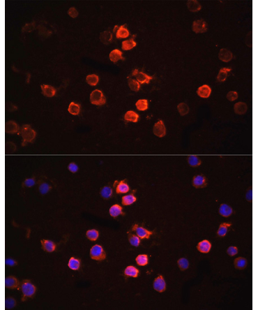 IL1Beta Rabbit Polyclonal Antibody