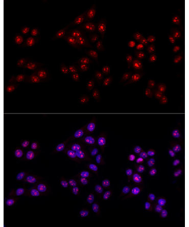 Ki67 Rabbit Polyclonal Antibody