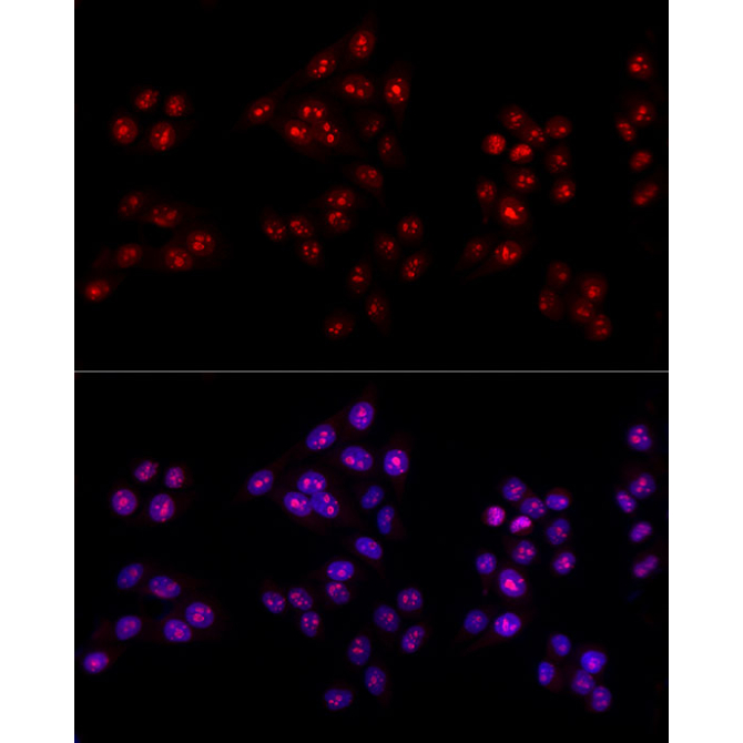 Ki67 Rabbit Polyclonal Antibody
