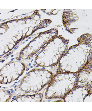 MMP9 Rabbit Polyclonal Antibody