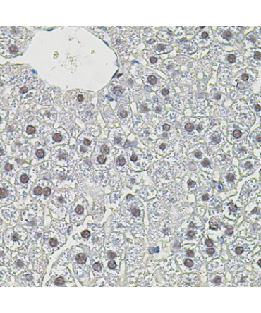 c-Myc Rabbit Polyclonal Antibody