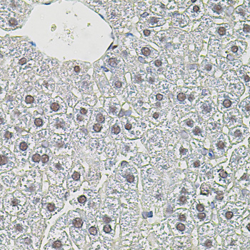 c-Myc Rabbit Polyclonal Antibody