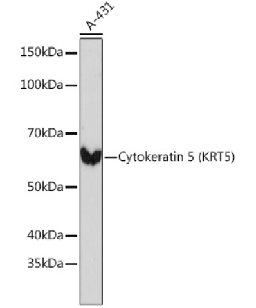 Cytokeratin 5 Rabbit Monoclonal Antibody