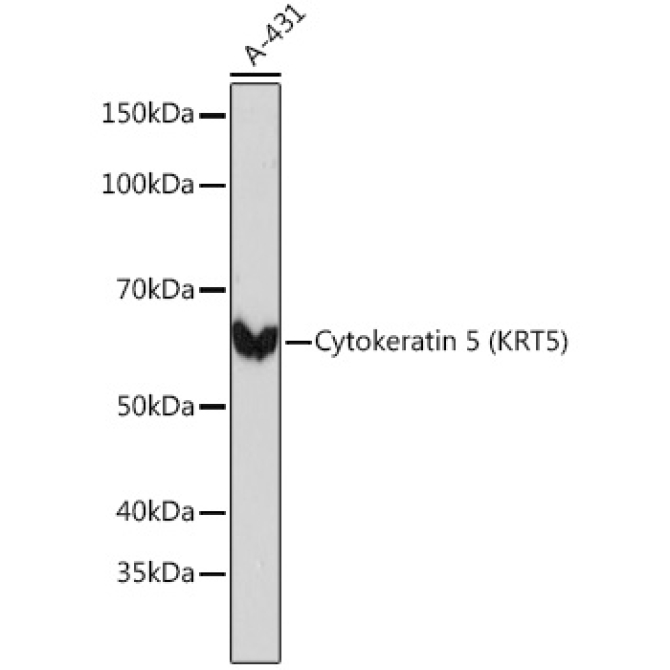 Cytokeratin 5 Rabbit Monoclonal Antibody