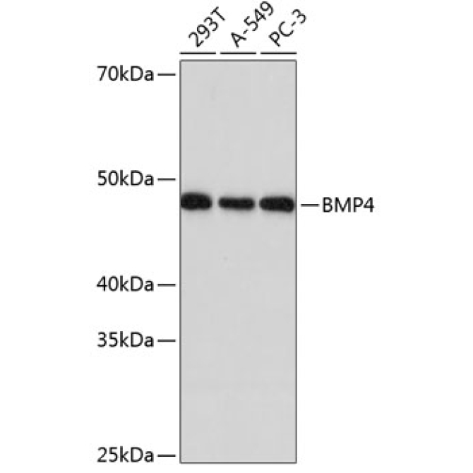 BMP4 Rabbit Monoclonal Antibody
