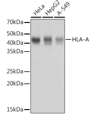 HLA-A Rabbit Monoclonal Antibody