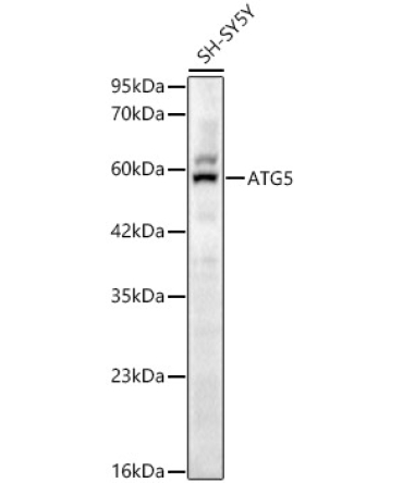 ATG5 Rabbit Polyclonal Antibody