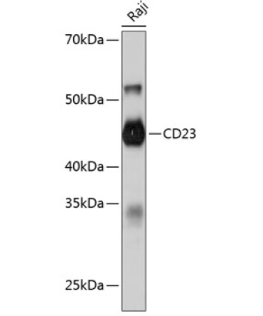 CD23 Rabbit Monoclonal Antibody