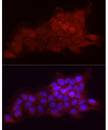 Fbx32/FBXO32 Rabbit Polyclonal Antibody