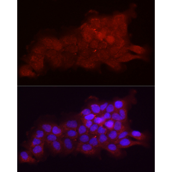 Fbx32/FBXO32 Rabbit Polyclonal Antibody