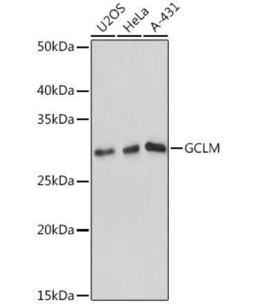 GCLM Rabbit Monoclonal Antibody
