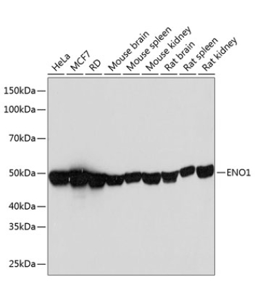ENO1 Rabbit Monoclonal Antibody