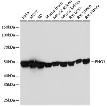 ENO1 Rabbit Monoclonal Antibody