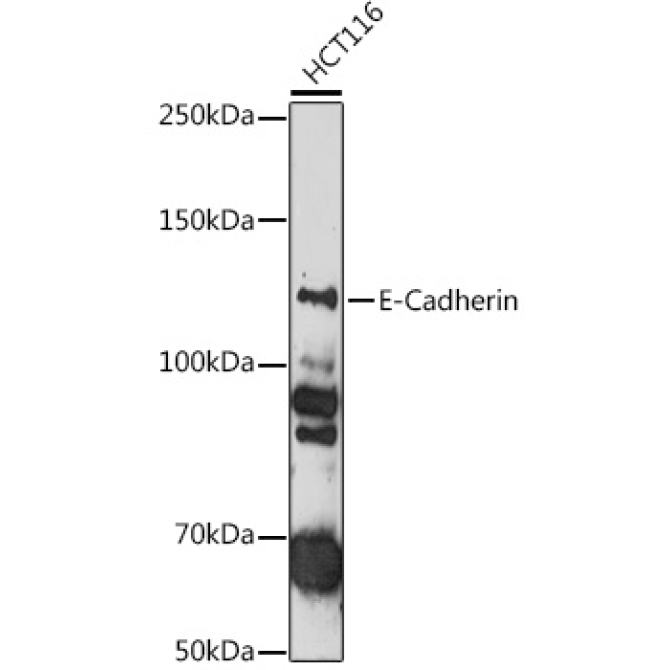 E-Cadherin Rabbit Polyclonal Antibody