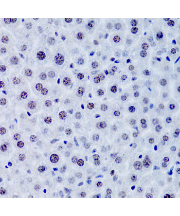 CDKN1A/p21CIP1 Rabbit Polyclonal Antibody