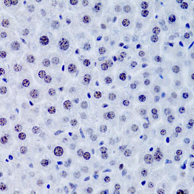 CDKN1A/p21CIP1 Rabbit Polyclonal Antibody