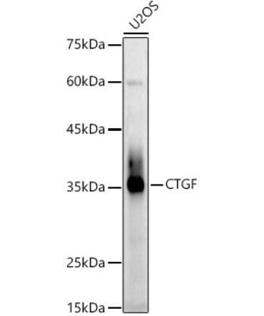 CTGF Rabbit Polyclonal Antibody