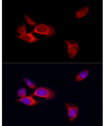 MLKL Rabbit Polyclonal Antibody