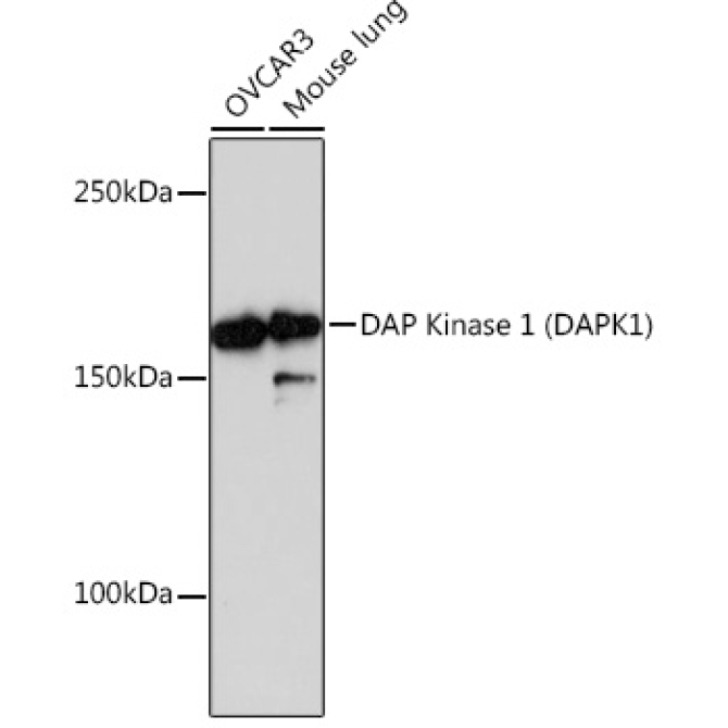 DAP Kinase 1 (DAPK1) Rabbit Monoclonal Antibody