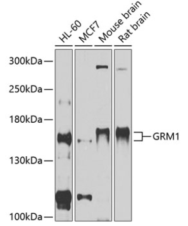 GRM1 Rabbit Polyclonal Antibody