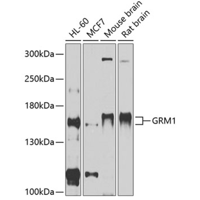 GRM1 Rabbit Polyclonal Antibody