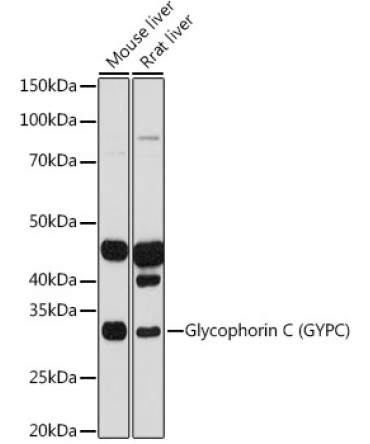 Glycophorin C (GYPC) Rabbit Monoclonal Antibody