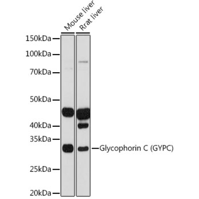 Glycophorin C (GYPC) Rabbit Monoclonal Antibody