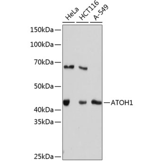 ATOH1 Rabbit Monoclonal Antibody