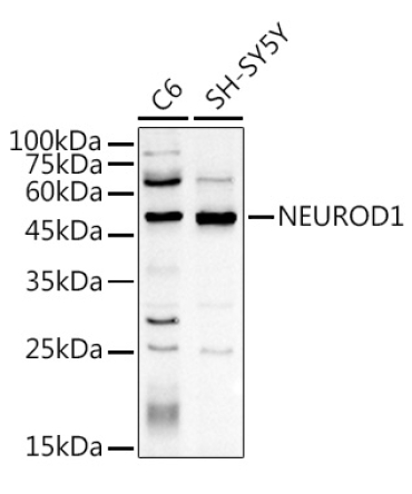 NEUROD1 Rabbit Polyclonal Antibody