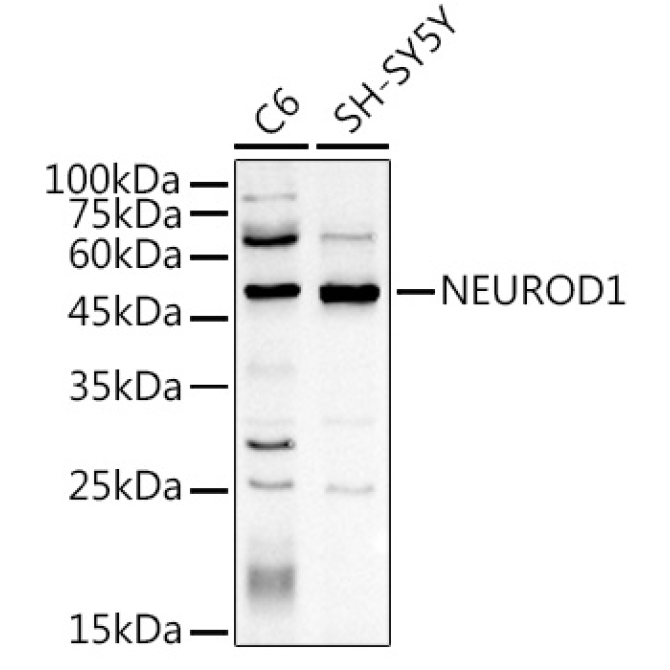 NEUROD1 Rabbit Polyclonal Antibody