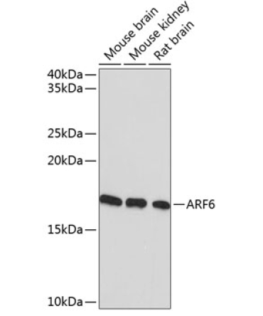 ARF6 Rabbit Monoclonal Antibody