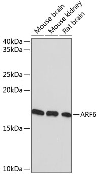 ARF6 Rabbit Monoclonal Antibody