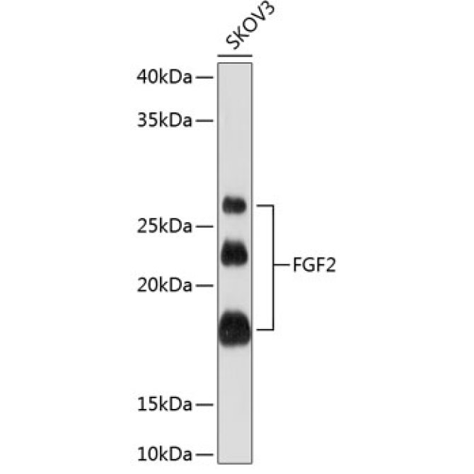 FGF2 Rabbit Monoclonal Antibody