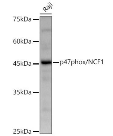 p47phox/NCF1 Rabbit Polyclonal Antibody