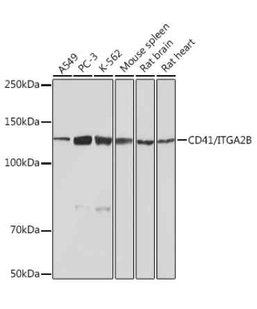 CD41/ITGA2B Rabbit Monoclonal Antibody