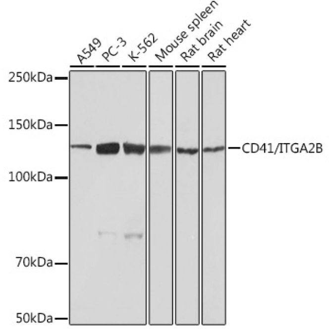 CD41/ITGA2B Rabbit Monoclonal Antibody