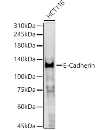 E-Cadherin Rabbit Polyclonal Antibody