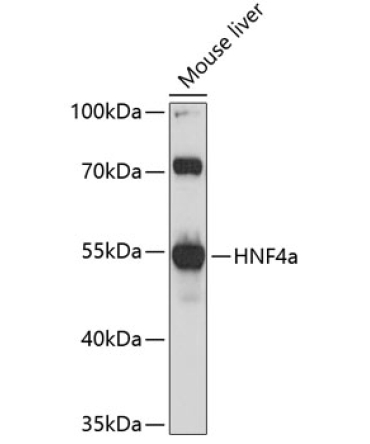 HNF4a Rabbit Polyclonal Antibody