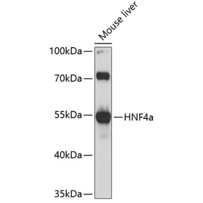 HNF4a Rabbit Polyclonal Antibody