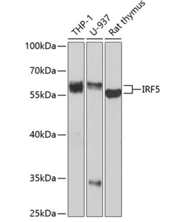 IRF5 Rabbit Polyclonal Antibody