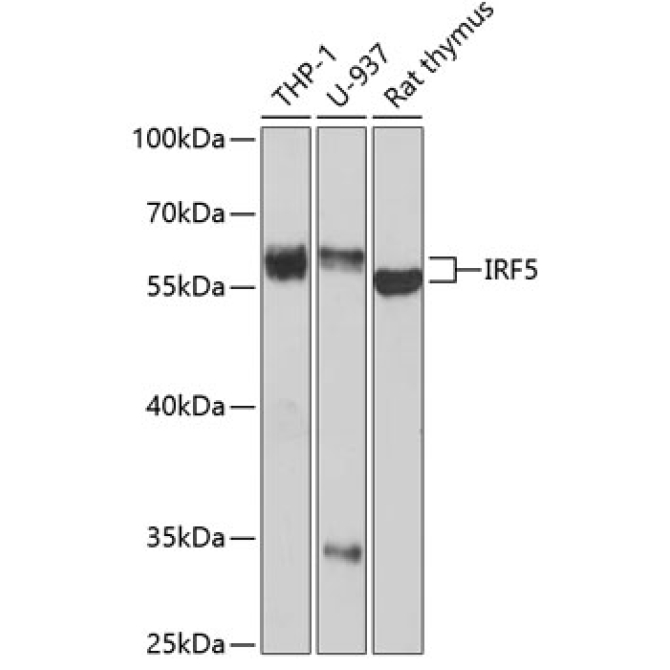 IRF5 Rabbit Polyclonal Antibody