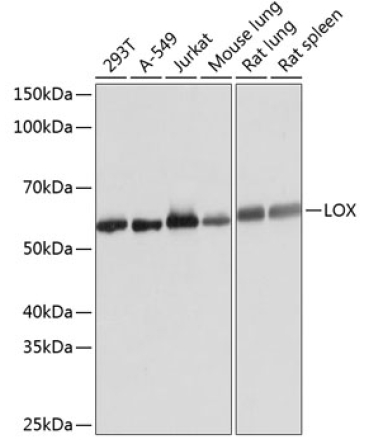 LOX Rabbit Monoclonal Antibody
